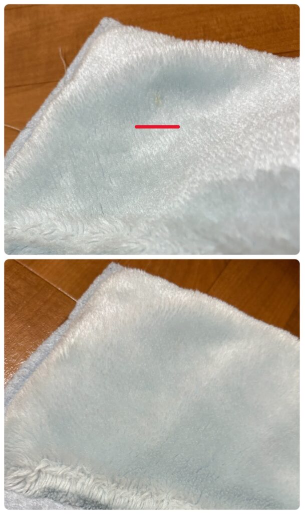 しももとクリーニング 結果 シミ1