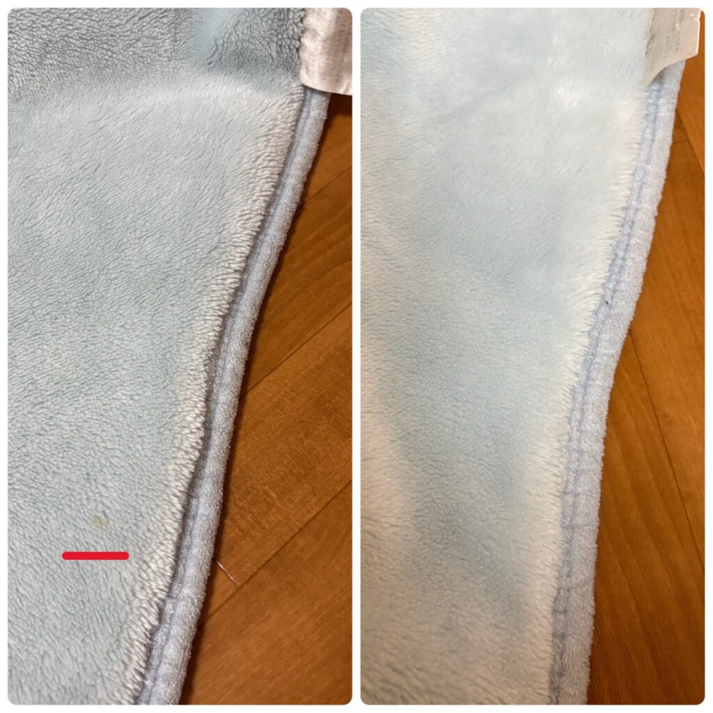 しももとクリーニング 結果 シミ2